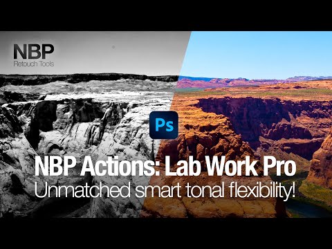 NBP Actions: Lab Work Pro